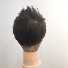 植毛 M字】植毛後ヘアシートを付けなくても自然なスタイル！ | INTI report |  薄毛に悩む男性の為の美容院「INTI[インティ]｜全席個室、東京・大阪・福岡に展開。